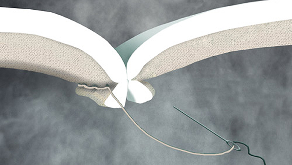 derbystar-materiaal-2